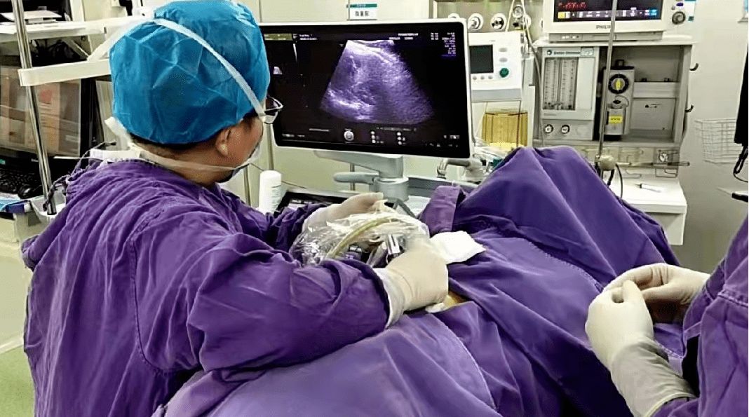 濮阳市人民医院超声消融术遇见子宫腺肌症