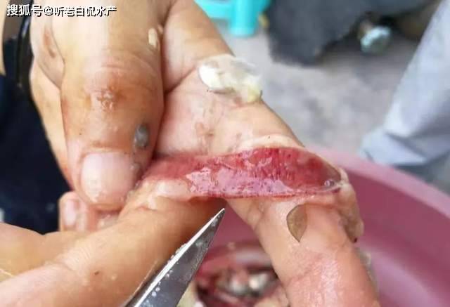 肠子烂了是什么病 来自搜狐网