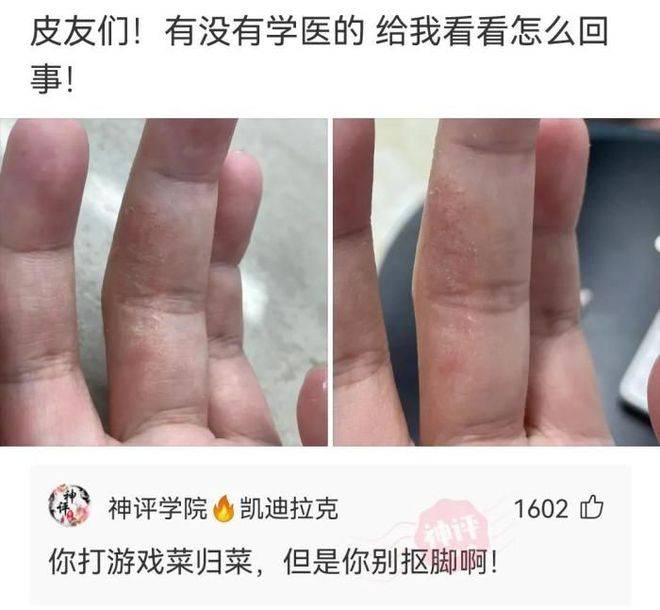 原创
搞笑GIF段子:女神发来照片说她受伤了,我大受震撼!
一、搞笑动态图,搞笑趣图!二、搞笑段子,爆笑笑话!
