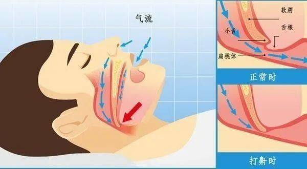 人体呼吸全过程示意图图片