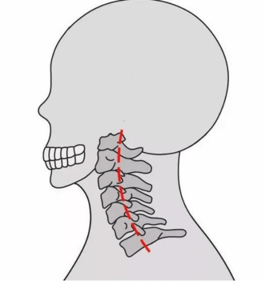 养世纪颈椎生理曲度变直怎么回事5招就能预防