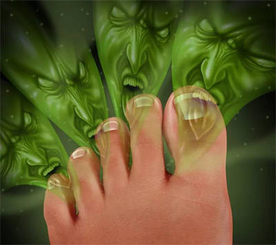 原创
别再用白醋大蒜治脚气了,后果很严重!看看正确的脚气治疗姿势是什么?