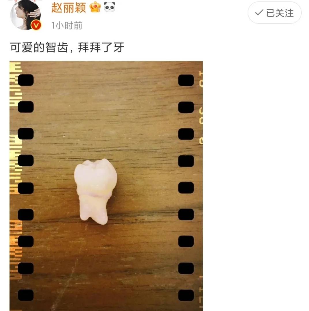 赵丽颖亮相被质疑整容撞脸张馨予 本人霸气回应刚拔智齿_杨幂_baby