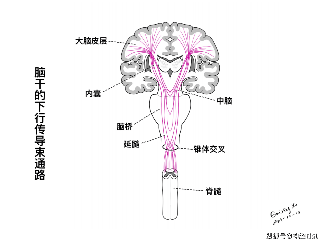 腦幹與顱神經的解剖與臨床(二)_綜合徵_大腦_位置