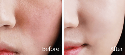 婷美小屋 | 真舒敏之星, 肌肤愈见强韧,耐受耐作_屏障_皮肤_结构