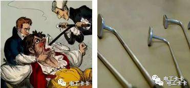 远至史前时期,人们就已经开始使用烙铁或烧红的石块处理伤口止血.