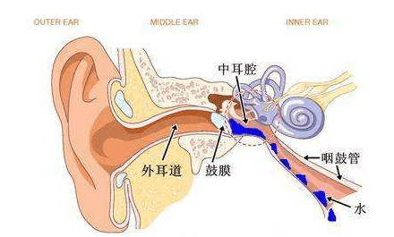 嚴重時可以引起鼓膜穿孔流水或流膿,這就是化膿性中耳炎