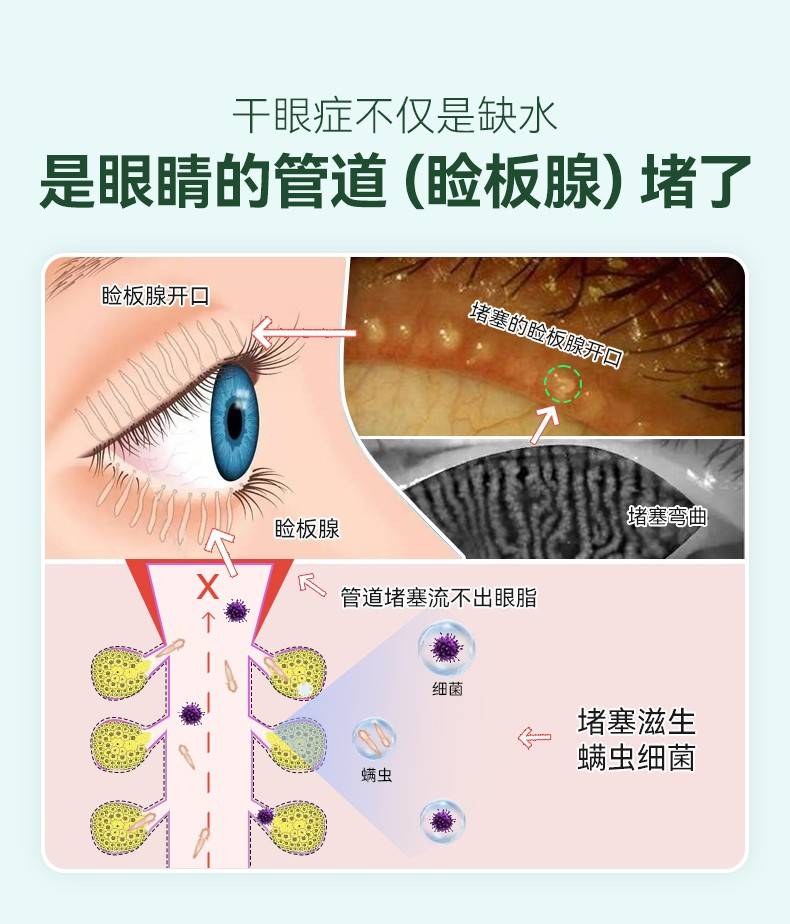 皇室御用品牌英国眼博士theeyedoctor茶树油湿巾给干眼症患者带来福音
