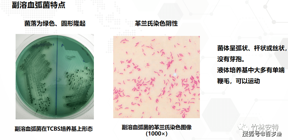 巴氏杆菌 显微镜图片