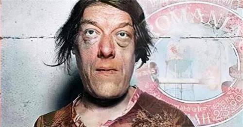 她是"世界级丑女",为养孩子参加选丑比赛赚钱,死后被制成标本贩卖