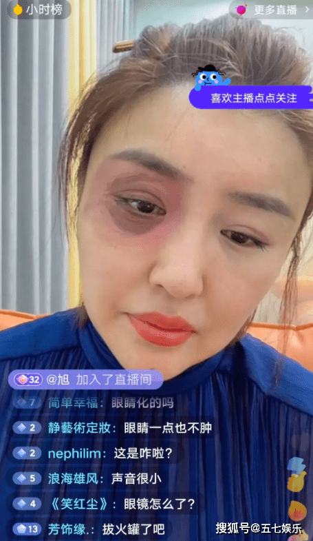 被前夫家暴,右眼被打黑青,或和赵本山坑其前夫投资有关_长春_眼睛_七