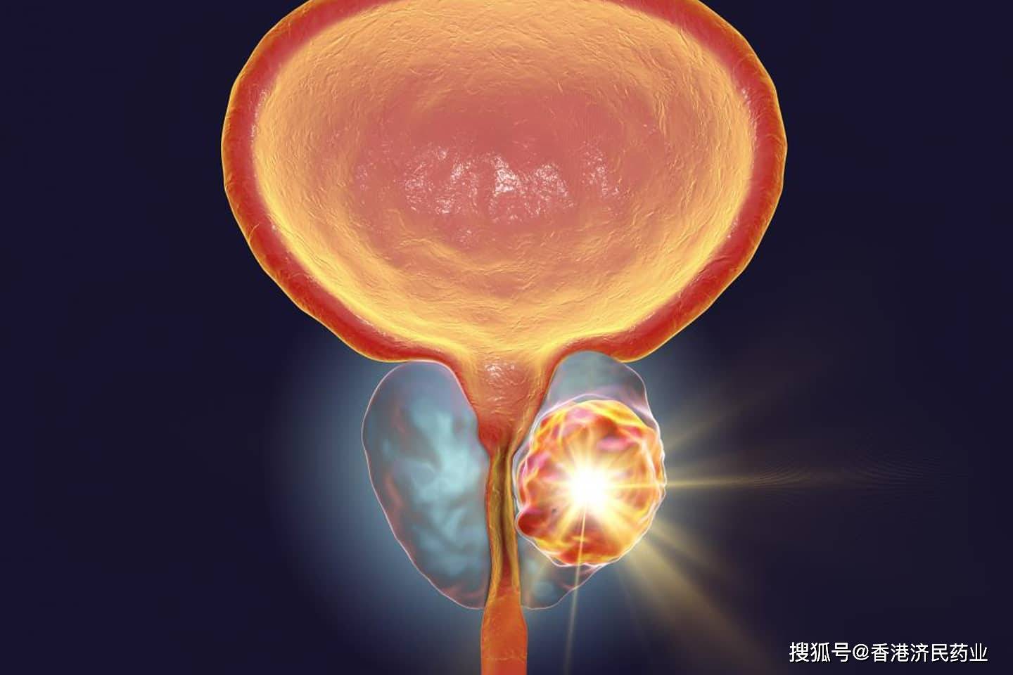 据myovant sciences于4月29日新闻稿宣布,欧盟委员