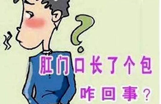 肛周脓肿和痔疮区别图片