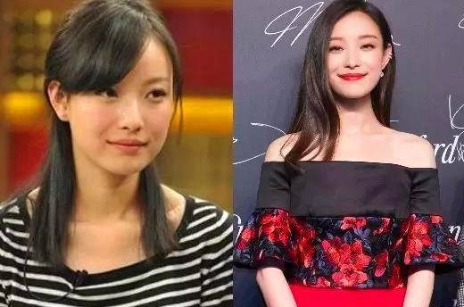 倪妮大量罕见童年照曝光,在公园表演一字马撞脸杨幂,整没整容一清二楚