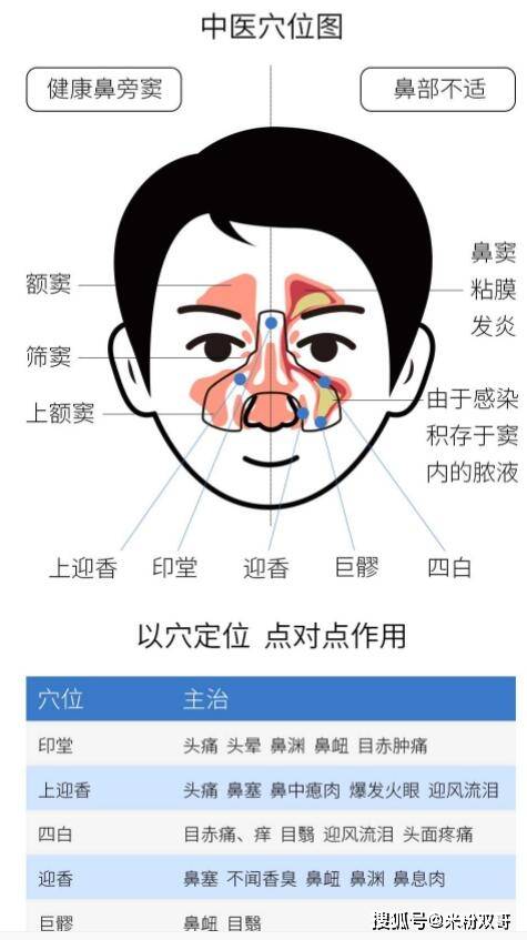 只要选对鼻炎贴鼻子就能通通通