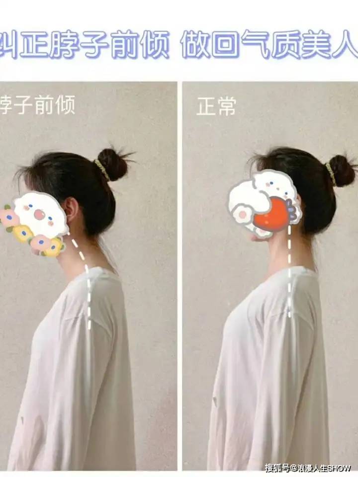 女性脖子前倾有哪些危害?颈椎变直后体态训练方法有哪些?