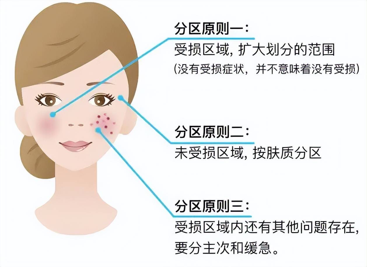 水媚蛙:世界上最远的距离,是鼻翼噗噗冒油,脸颊刷刷掉屑