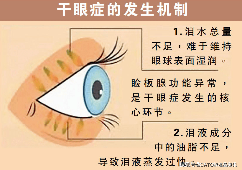 帮助泪液均匀分布在角膜上;中间层是水样层,具有湿润作用,能提供眼睛
