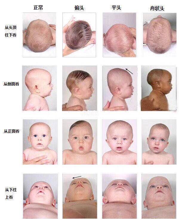宝宝正常头型标准图片图片