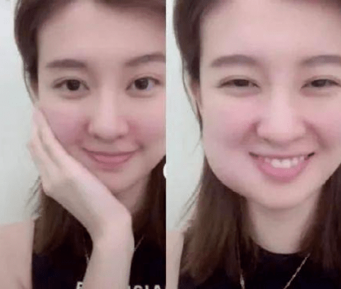 乔欣在娱乐圈是出了名的脸小骨架小的女明星,可要是遇上了拔智齿也是