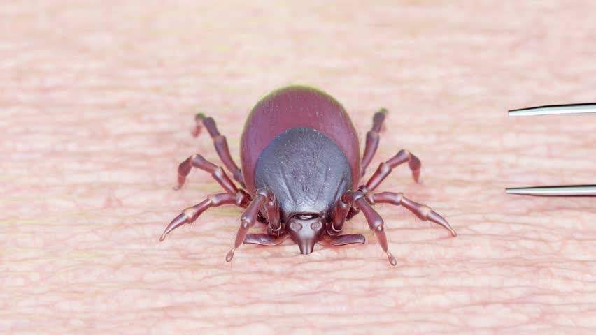 专家建议,去除蜱虫时,尽量用比较尖的镊子,在接近皮肤的位置上夹住