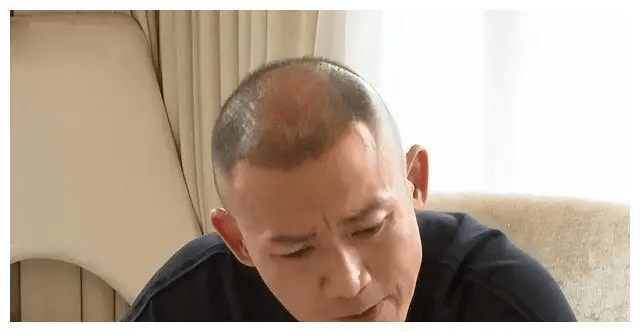 不过或许是常年拍古装剧,男演员都需要戴假发套,久而久之对头皮也有