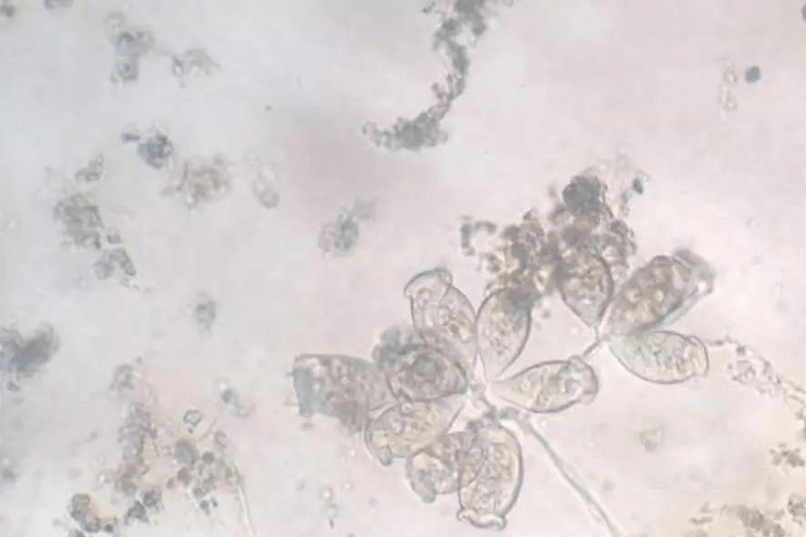 鱼类体外共栖而非寄生的固着类纤毛虫—聚缩虫、累枝虫、杯体虫等_养殖_钟形_虫体