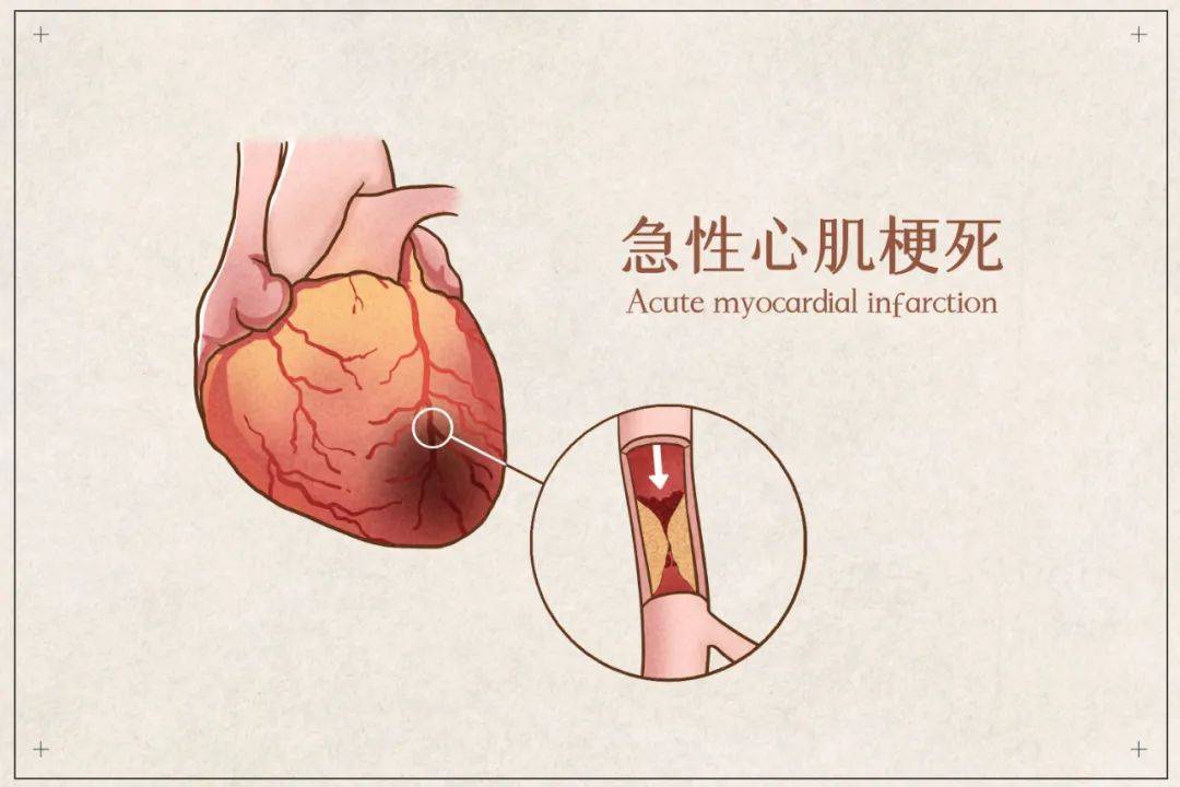 日本千叶大学做了系列研究,2008年,他们在大鼠心脏缺血再灌注模型用富