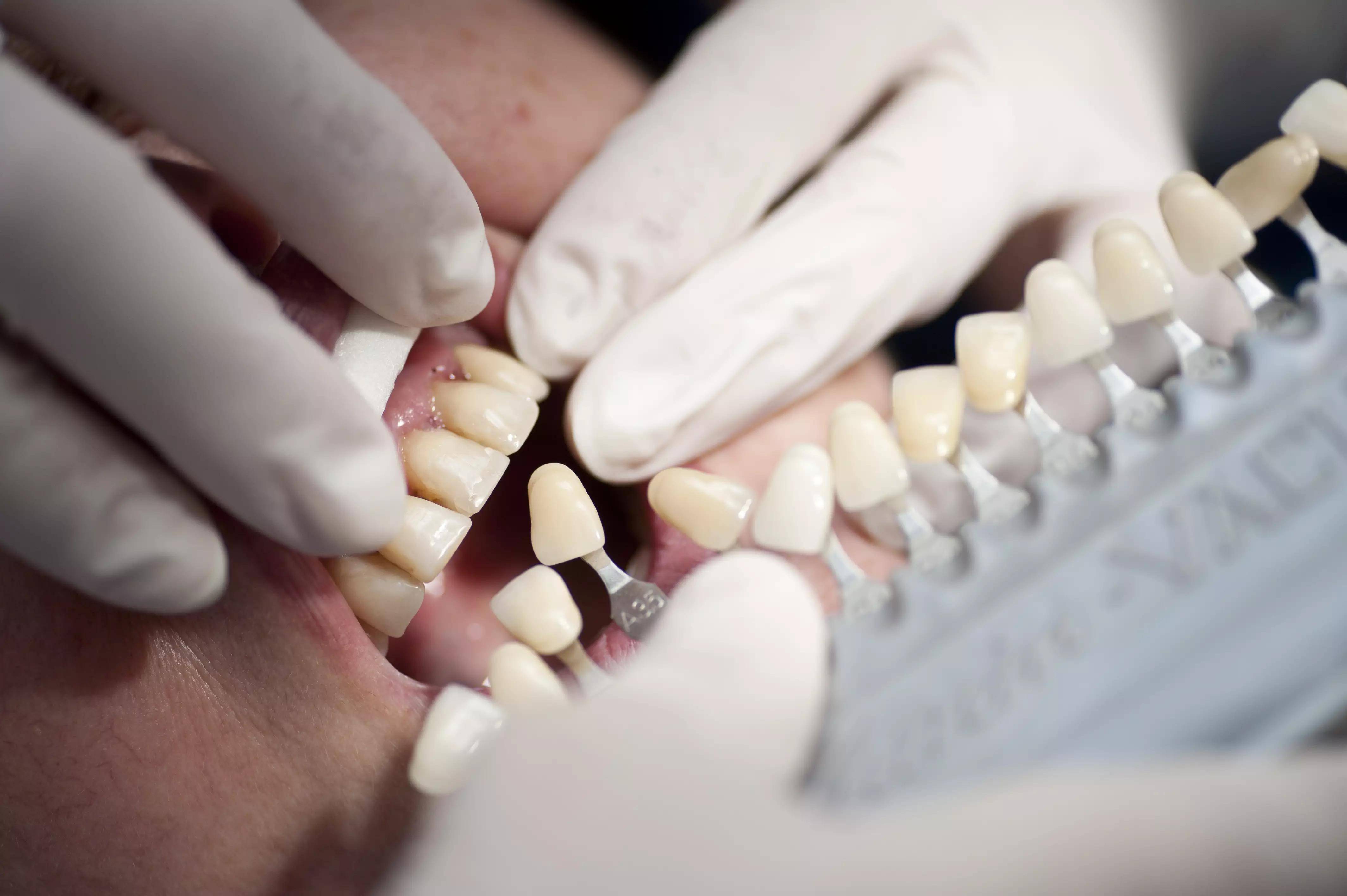 原创人类牙齿与进化