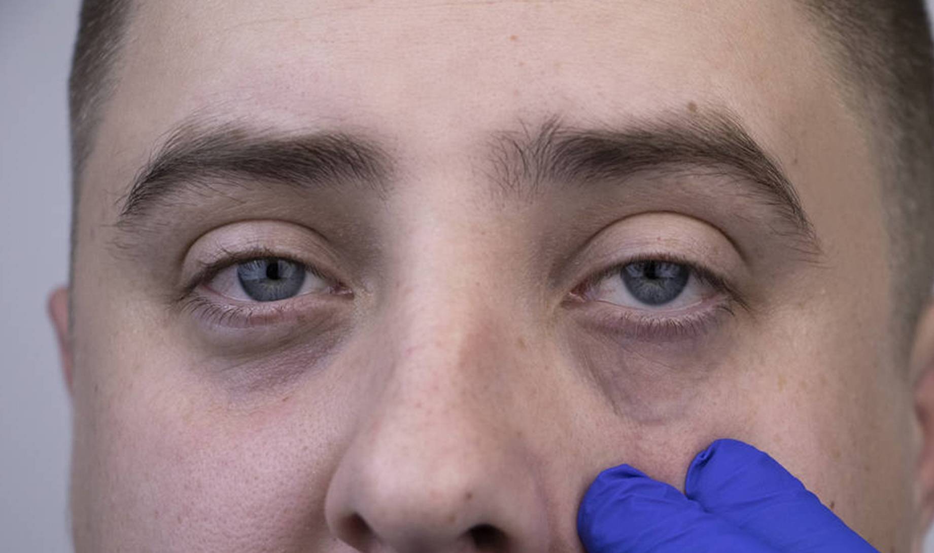 男性衰老"加速器"公布,烟酒排第二,看完榜首,赶紧改,别犹豫_身体