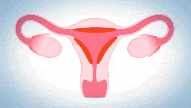 炎|子宫内膜异位症|月经错乱随时都有可能诱发许多顽固性妇科病胞宫