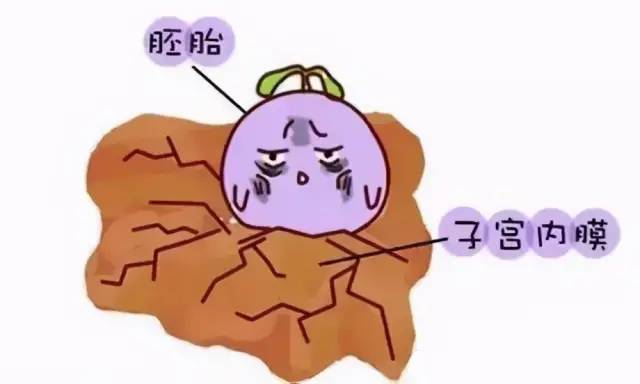 对受精卵着床造成限制,包括宫腔粘连,子宫内膜异位症,单角子宫,双角