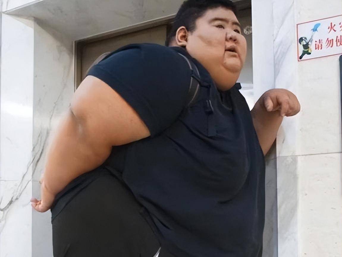 原创山东第一胖王浩楠晒手臂肌肉自证减肥成功皮肤却成亮点