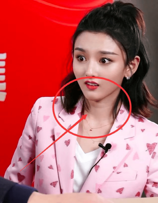 杨紫的法令纹,关晓彤的木偶纹,这些明星才20多岁,却提前显老_眼窝_卜