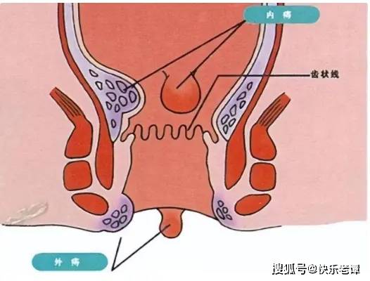 你有洗肛門的習慣嗎對身體有啥影響建議瞭解