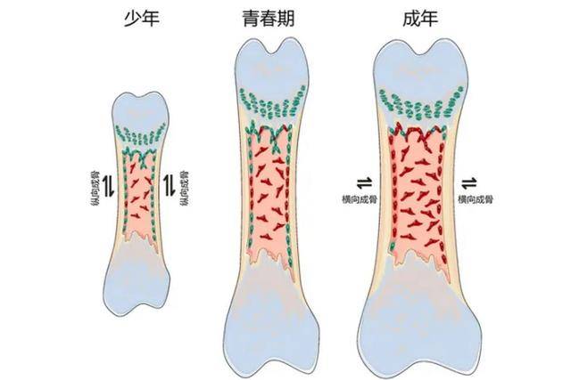 可能会加速骨垢闭合