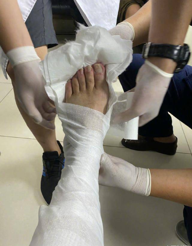 63岁潘长江带伤坚持工作,近照腿受伤状态却佳,不用替身好模范_网络_祝