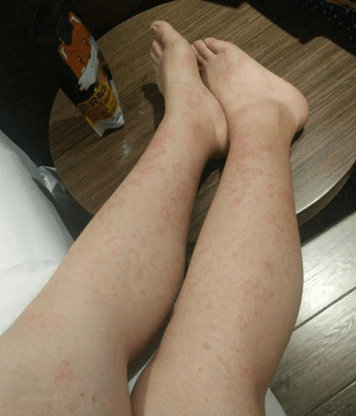 夏天基本是告别短裤凉鞋的.