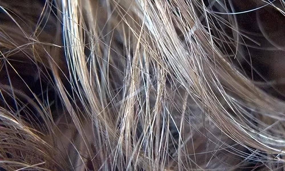 昆明发丝管理头发缺水的表现是什么