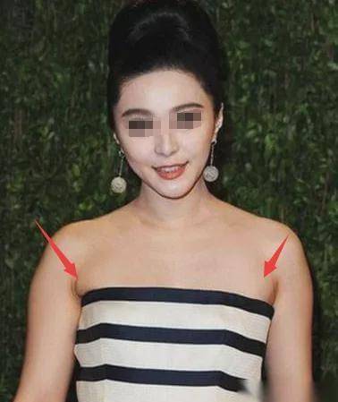 ▼另外,副乳多的女生穿这种抹身材裙也是大型踩雷现场,来看看范爷这