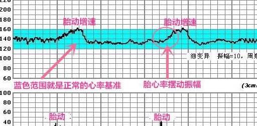医生如何看胎心监护图,孕33周胎监不过关怎么办?