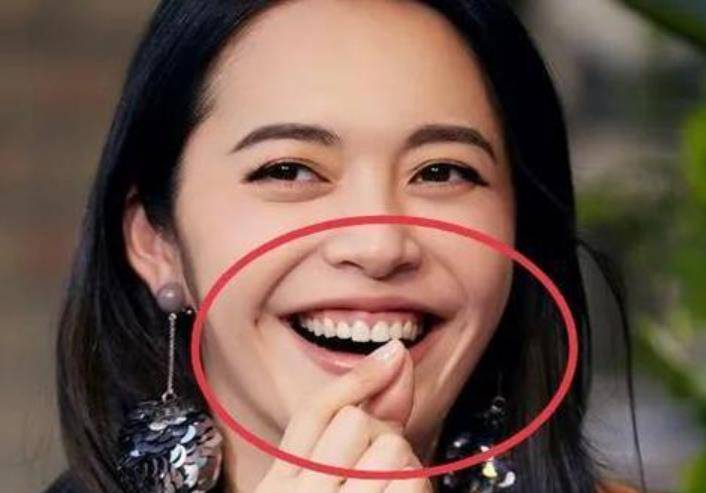 刘涛牙齿脱落,吴宣仪嘴巴合不上,明星们的大白牙真的好看吗?