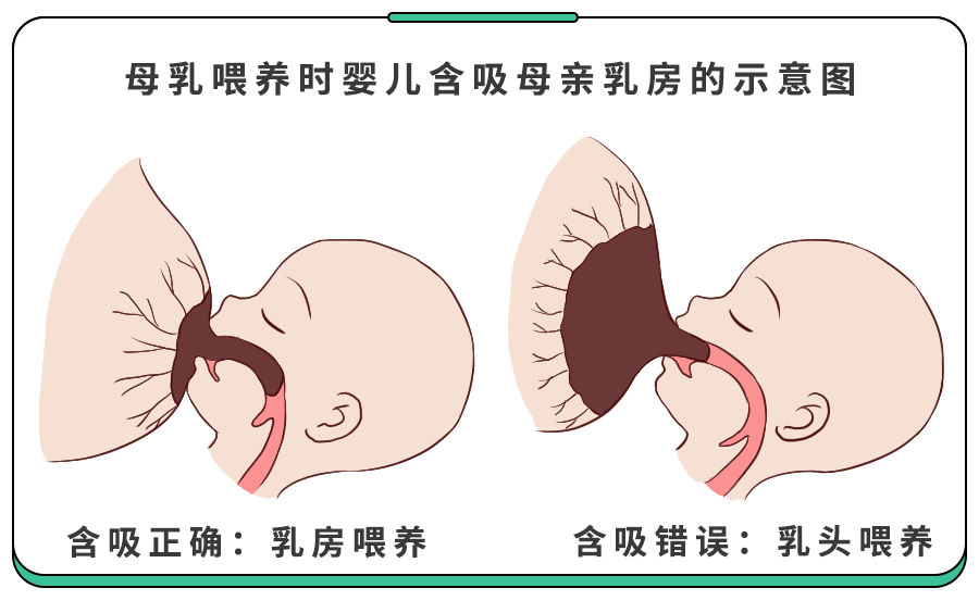 怎么判断孩子有没有肠胀气(肠胀气怎么缓解)