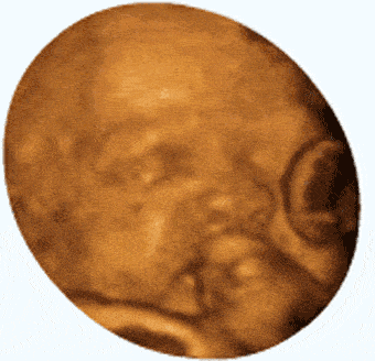 孕22周男孩睾丸b超图图片