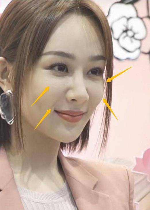 杨紫新造型再度拉垮,脸部充气状态明显,细看鼻子付出的代价好大_活动