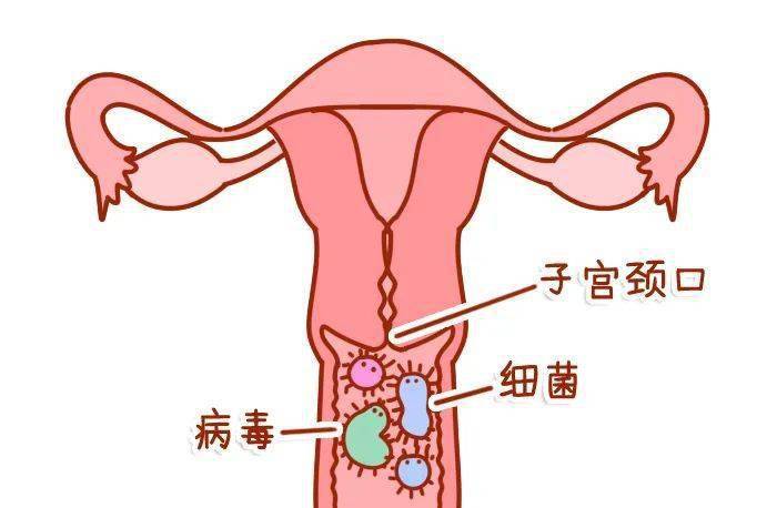 这5种所谓的＂妇科病＂,其实都不是病,别再害怕了