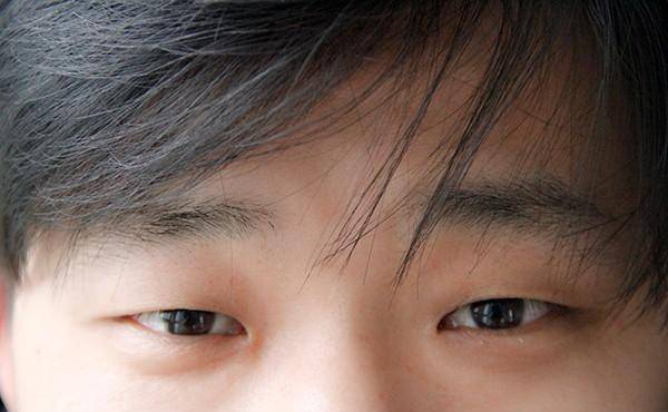 很多老年人不在意,双眼真的"伤不起"_张大爷_眼睛_问题