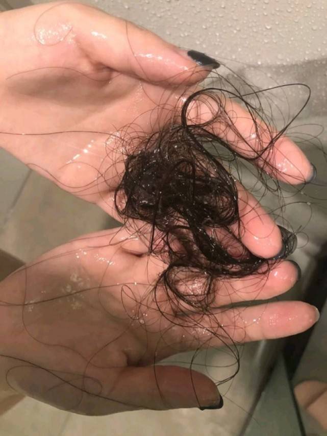 脱发别慌?教你3招轻松长出健康新发!错过追悔莫及!_头发_按摩_头皮