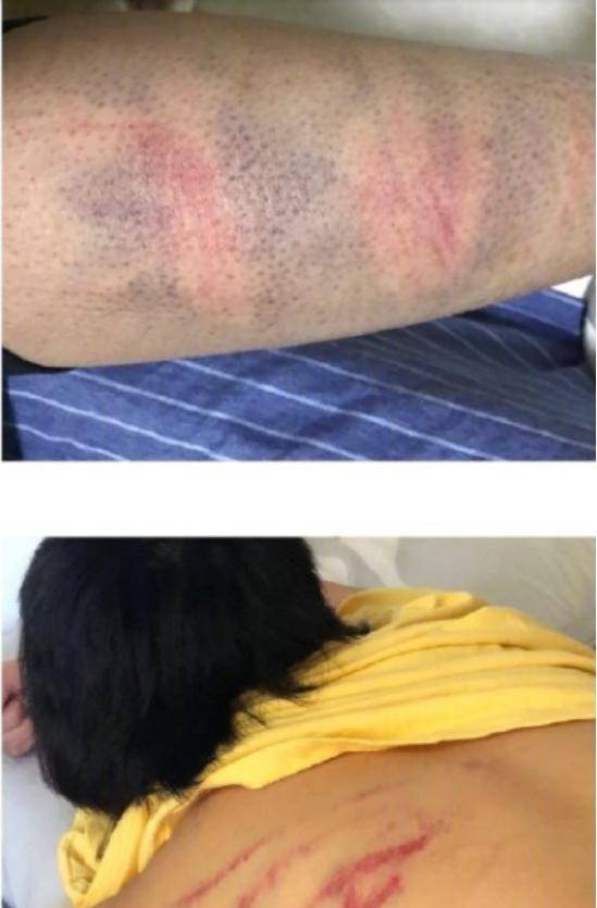 张嫮目家暴女友,是否和蒋劲夫一样另有隐情?