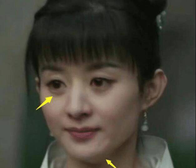 35岁赵丽颖被嘲:嘴歪了,苹果肌肿胀,硅胶感明显被质疑医美变脸_网友